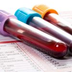 Hemoglobin Darah Terlalu Tinggi Juga Berbahaya