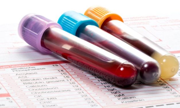 Hemoglobin Darah Terlalu Tinggi Juga Berbahaya