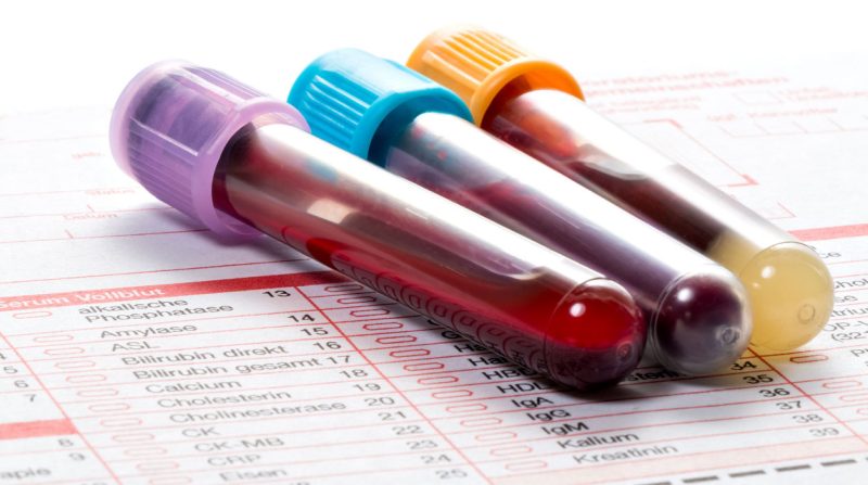Hemoglobin Darah Terlalu Tinggi Juga Berbahaya