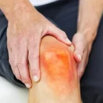Tips Mencegah Asam Urat agar Sendi Tetap Sehat Dan Nyaman
